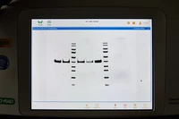 Dünnschicht Chromatographie